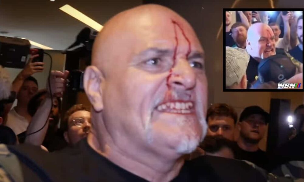 Bloody John Fury headbutt