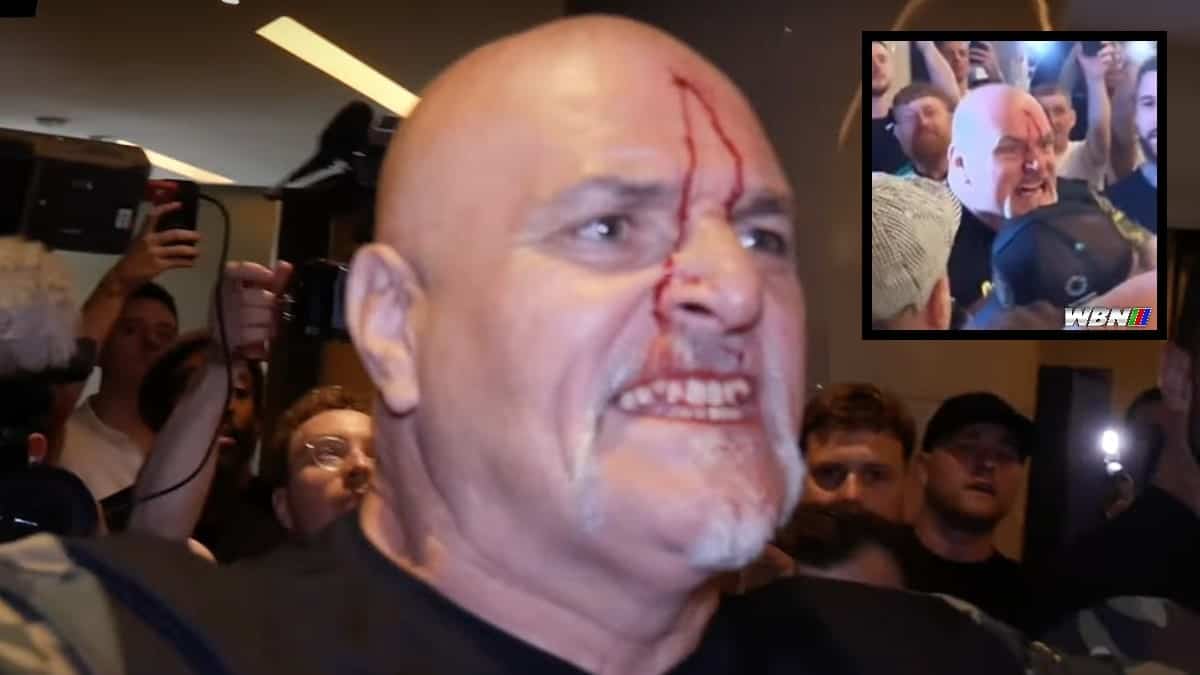 Bloody John Fury headbutt