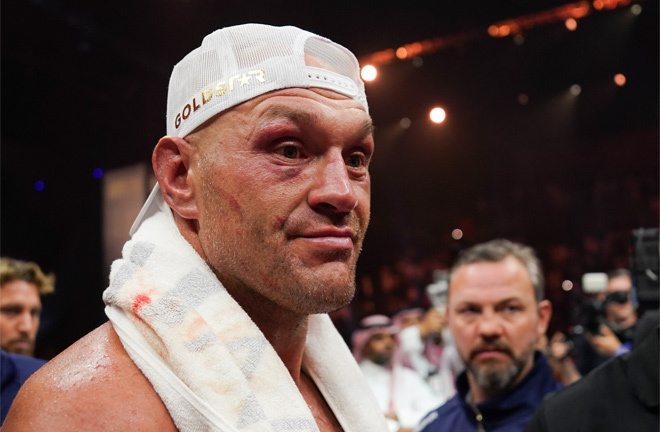 Tyson Fury has promised to send Oleksandr Usyk into retirement on Saturday Photo Credit: Mikey Williams/Top Rank