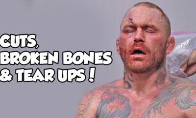 CUTS, BROKEN BONES & TEAR UPS! - This Is BARE KNUCKLE BRAWLING!