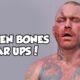 CUTS, BROKEN BONES & TEAR UPS! - This Is BARE KNUCKLE BRAWLING!