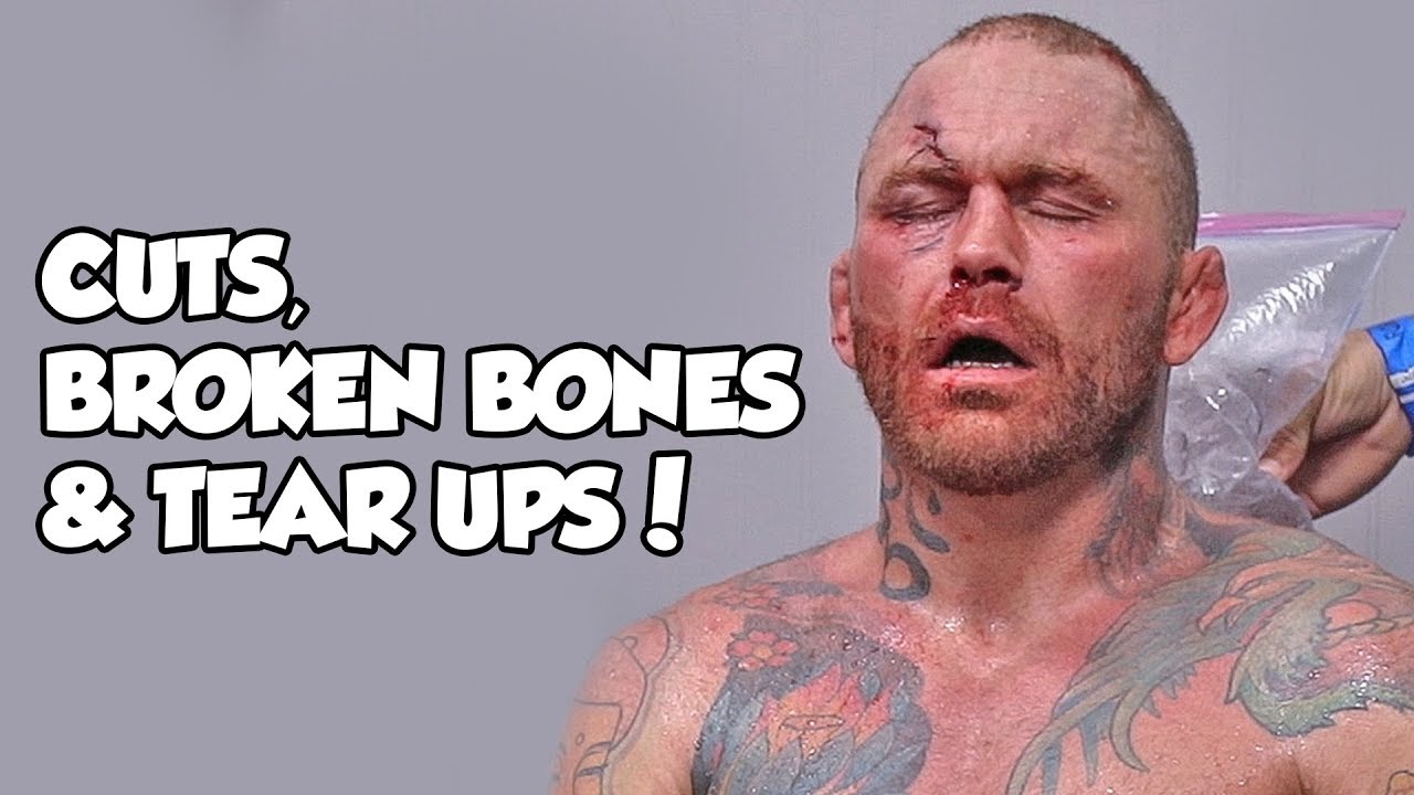 CUTS, BROKEN BONES & TEAR UPS! - This Is BARE KNUCKLE BRAWLING!