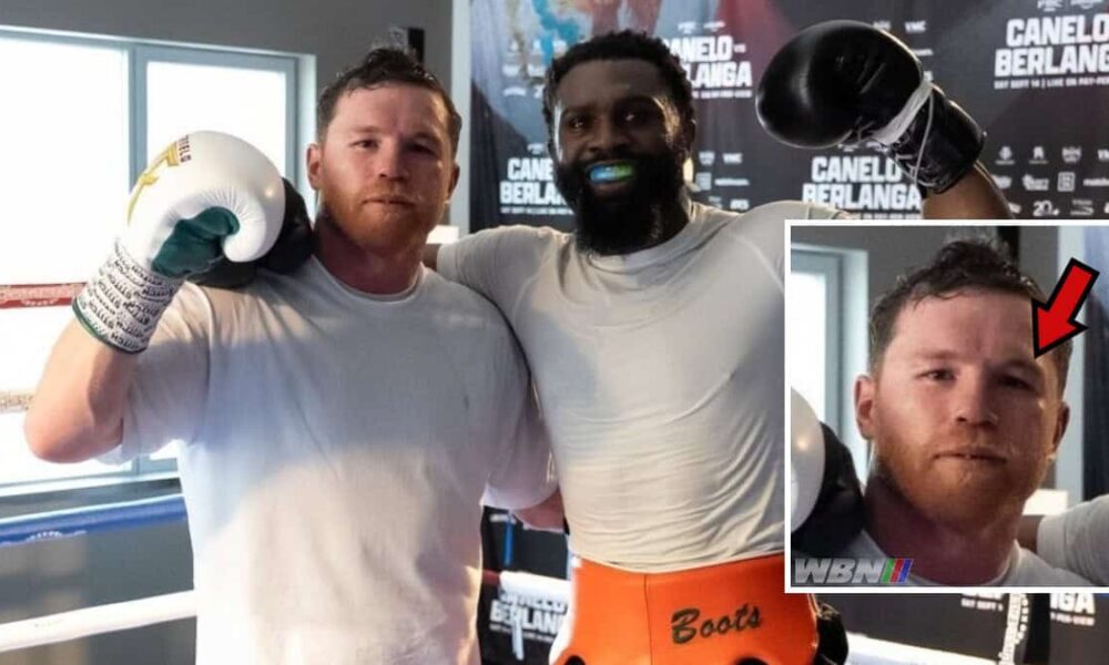Canelo Ennis black eye