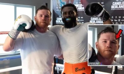 Canelo Ennis black eye