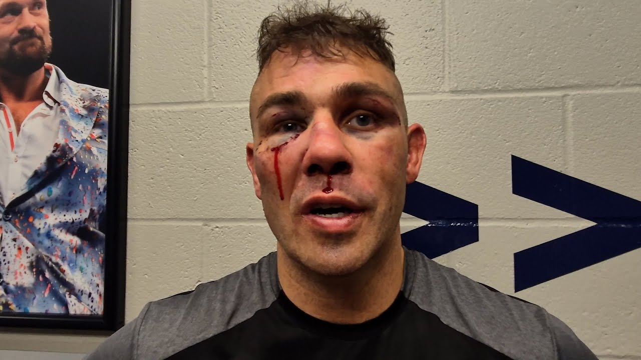 BRUISED & CUT Matty Floyd AFTER JAMES DEGALE BAREKNUCKLE DEFEAT: 'I THOUGHT I WON!