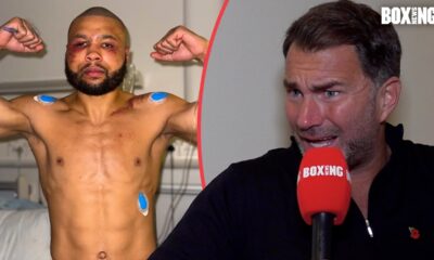 Eddie Hearn FIRES BACK At Chris Eubank Jr Ambulance Video, Legal Case & Ortiz-Ennis