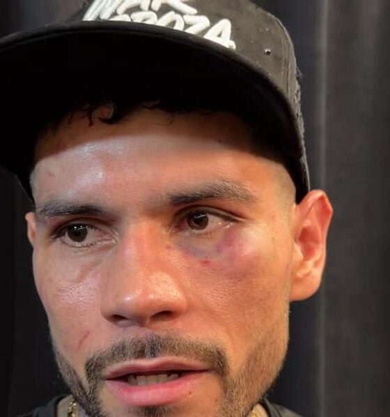 Image: Arnold Barboza Jr. names Ryan, Haney, Teofimo as next targets