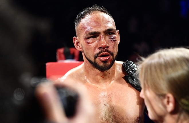 Thurman was stopped for the first time in his career against Fundora Photo Credit: Premier Boxing Champions