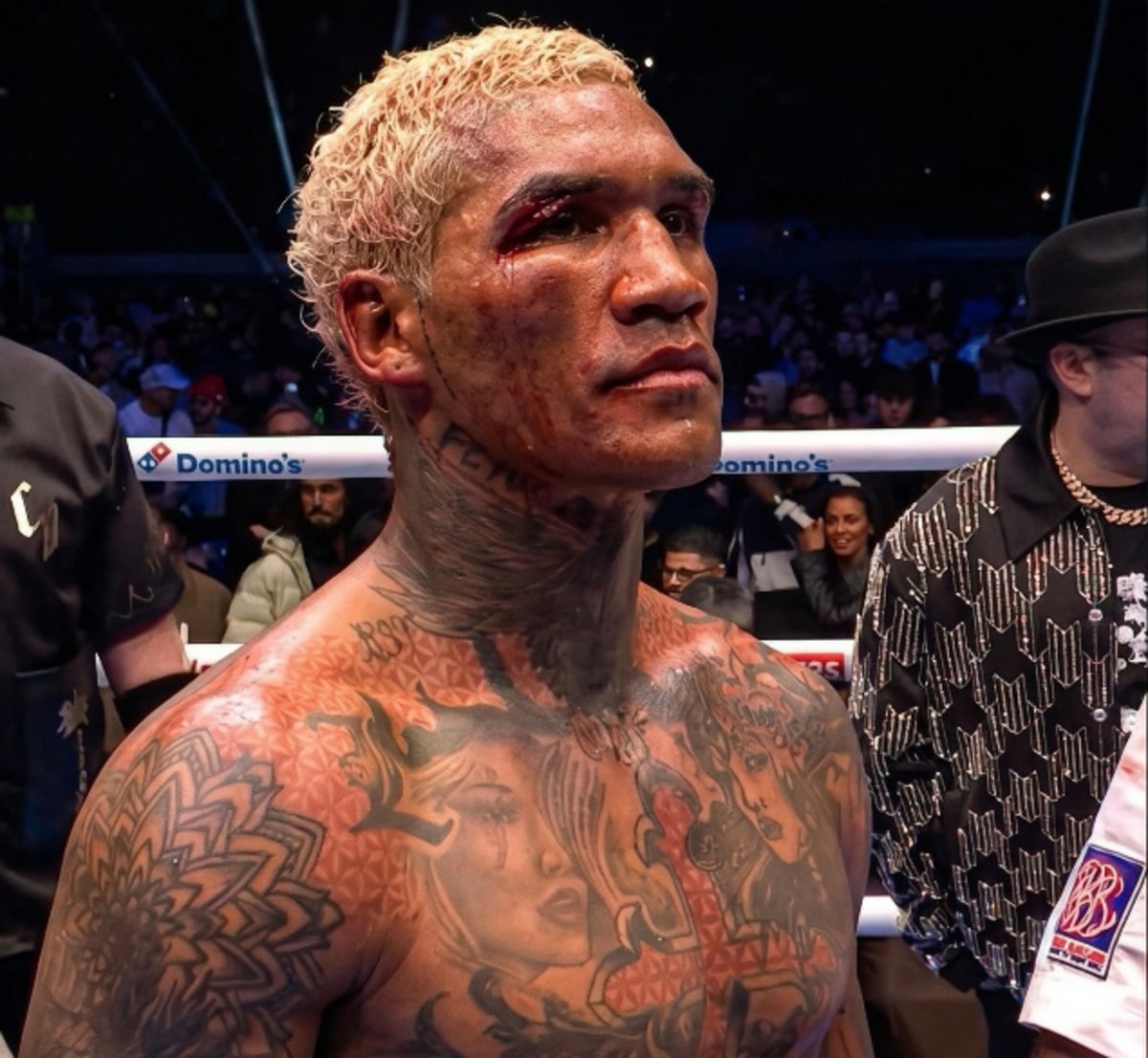 Image: Broadcast moves on quickly after Conor Benn win, Mannix questions it
