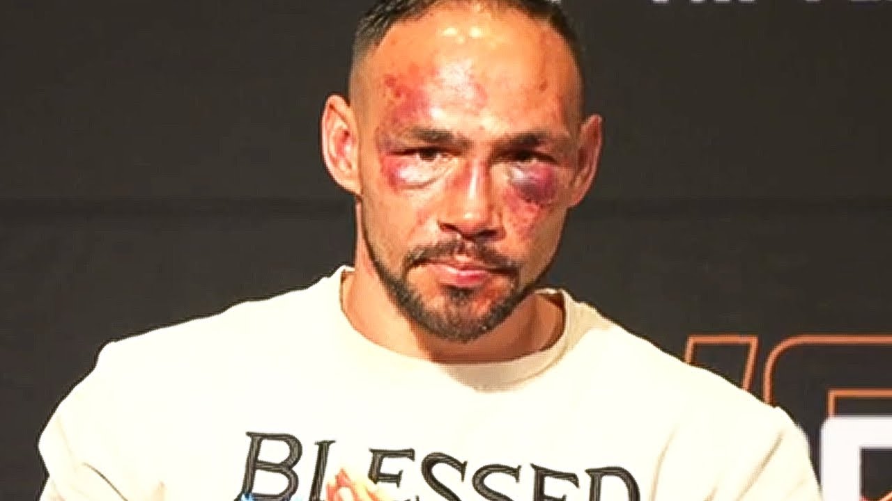 Keith Thurman DAY AFTER Getting STOPPED by Sebastian Fundora: “The Show Is Not Over!”