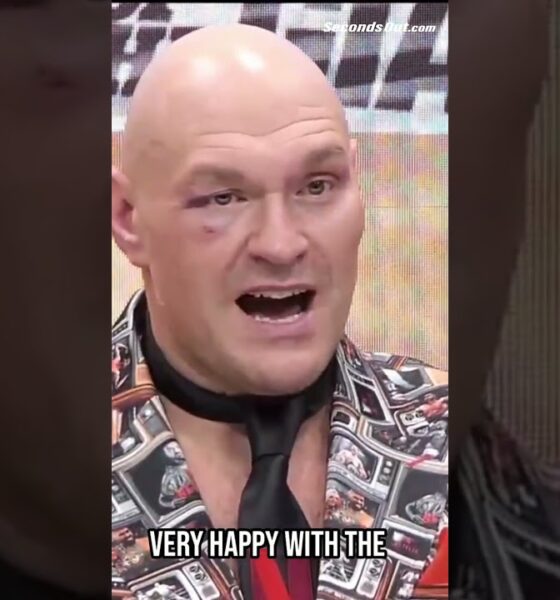 😤 Tyson Fury - 'THERE'S ONLY ONE BOSS ON THESE SHORES'