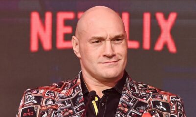 Tyson Fury 2026 face
