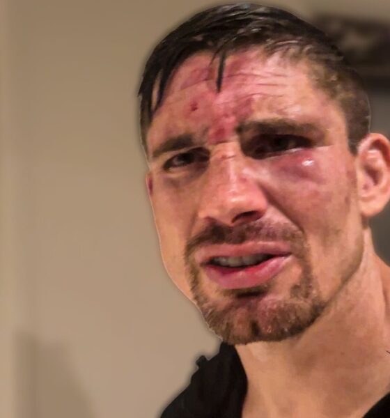 “STOPPED AFTER THE BELL! WE WILL APPEAL” Rico Verhoeven FUMES Over Controversial Oleksandr Usyk KO