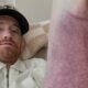 Cory Sandhagen details brutal hamstring injury suffered in UFC 329 loss