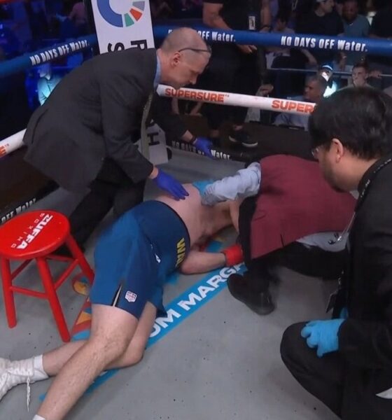 "Heavyweight Shocks Again: Tyson Fury Left Bloodied and Knocked Out Cold"