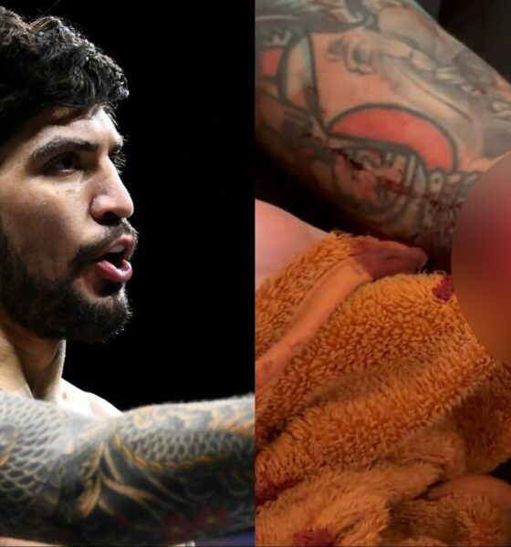 GRAPHIC | Dillon Danis shares nasty aftermath of injury that forced Mike Perry fight withdrawal