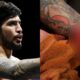 GRAPHIC | Dillon Danis shares nasty aftermath of injury that forced Mike Perry fight withdrawal