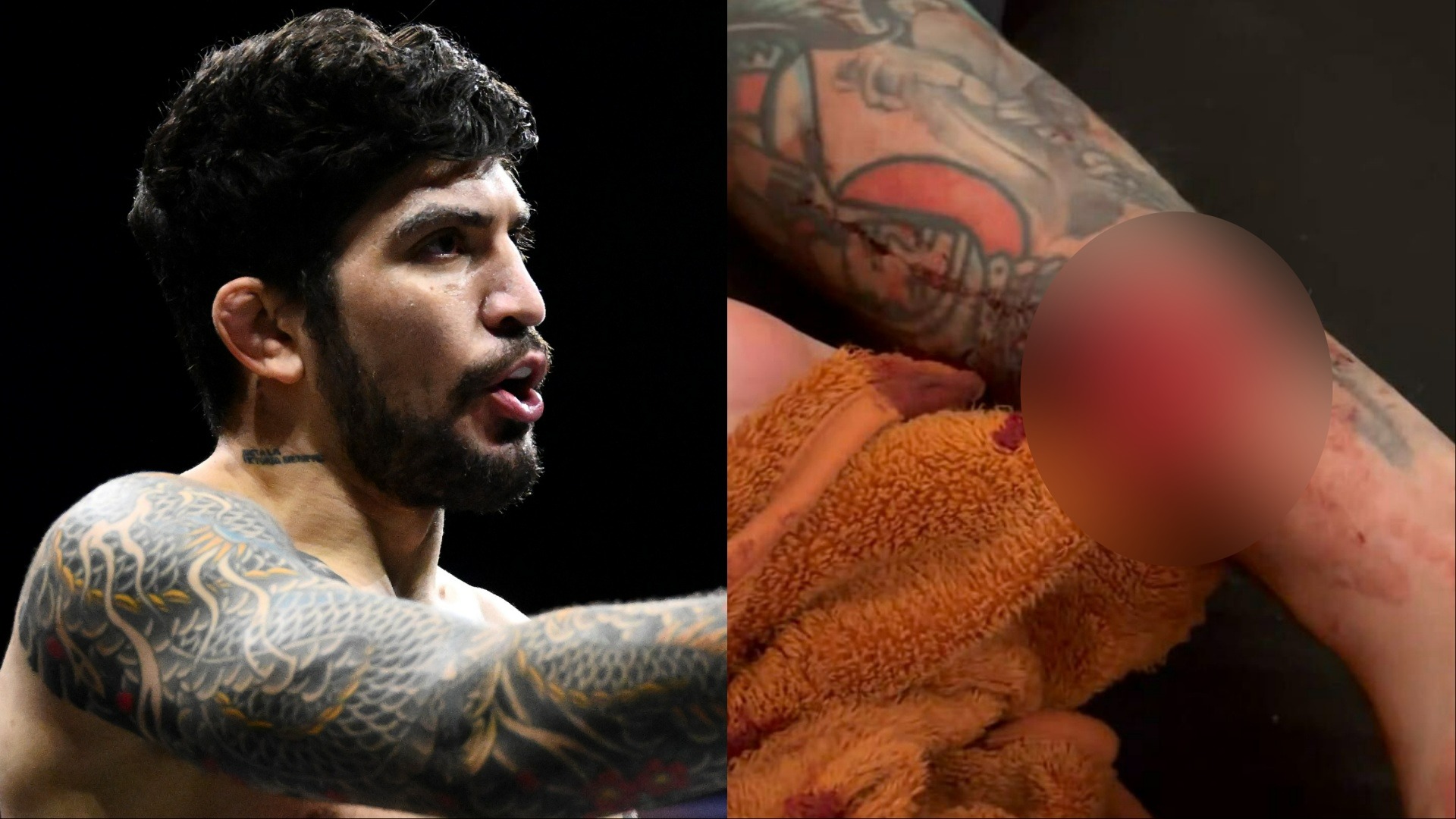 GRAPHIC | Dillon Danis shares nasty aftermath of injury that forced Mike Perry fight withdrawal